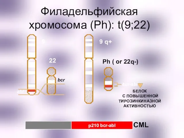 Филадельфийская хромосома (Ph): t(9;22) 22 bcr abl Ph ( or