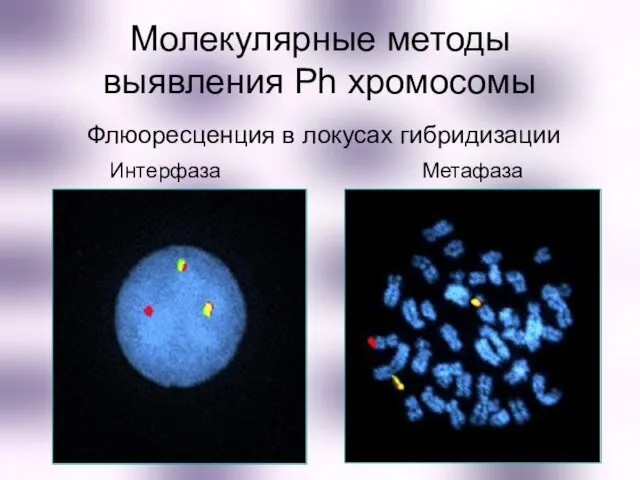 Флюоресценция в локусах гибридизации Интерфаза Метафаза Молекулярные методы выявления Ph хромосомы