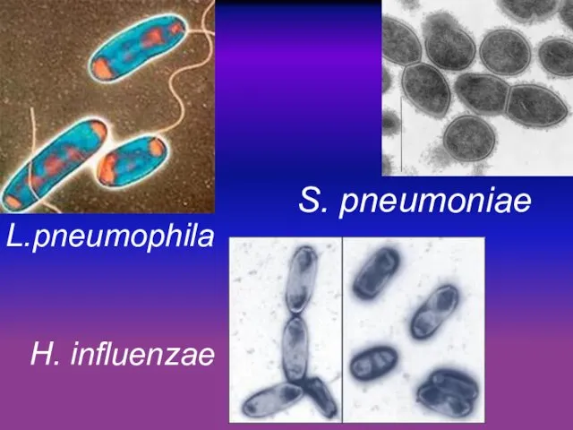 L.pneumophila S. pneumoniae H. influenzae