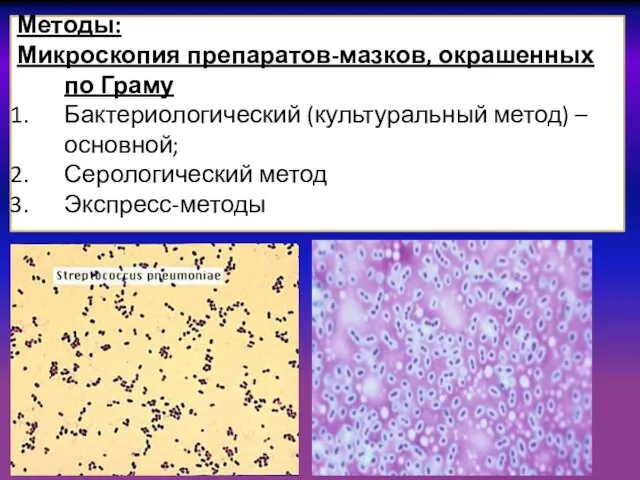 Методы: Микроскопия препаратов-мазков, окрашенных по Граму Бактериологический (культуральный метод) –основной; Серологический метод Экспресс-методы