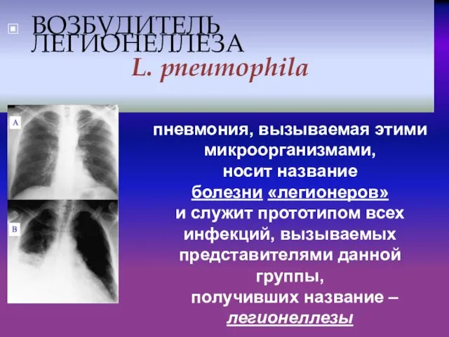 ВОЗБУДИТЕЛЬ ЛЕГИОНЕЛЛЕЗА L. рneumophila пневмония, вызываемая этими микроорганизмами, носит название