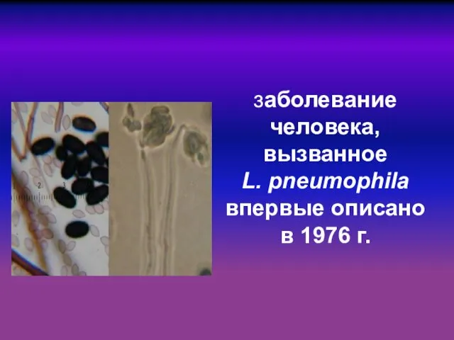 заболевание человека, вызванное L. рneumophila впервые описано в 1976 г.