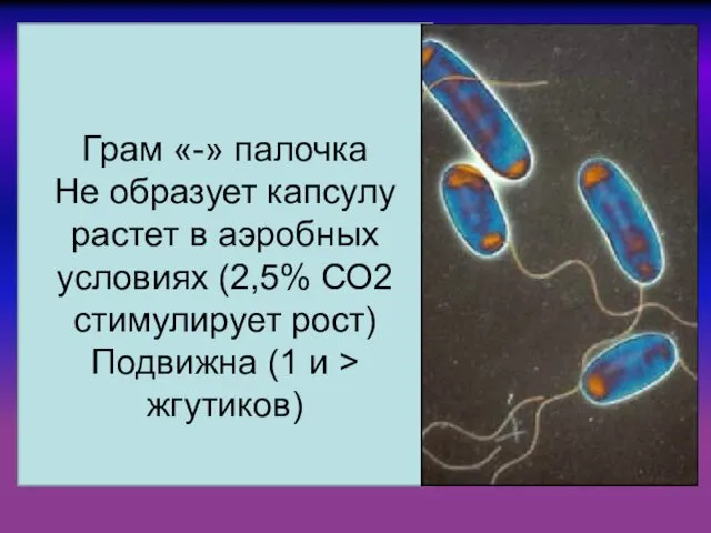 Грам «-» палочка Не образует капсулу растет в аэробных условиях