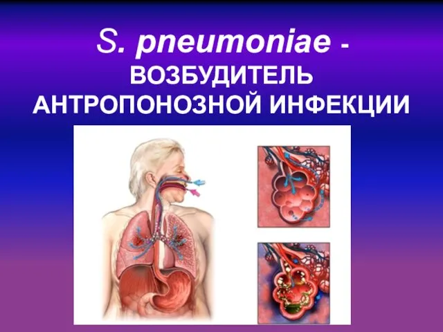 S. pneumoniae - ВОЗБУДИТЕЛЬ АНТРОПОНОЗНОЙ ИНФЕКЦИИ