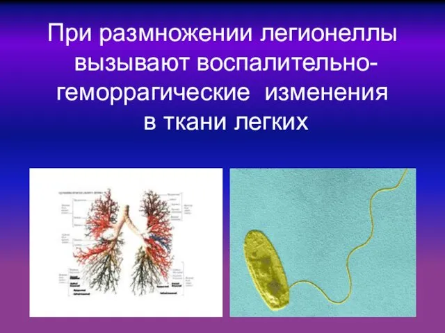 При размножении легионеллы вызывают воспалительно-геморрагические изменения в ткани легких