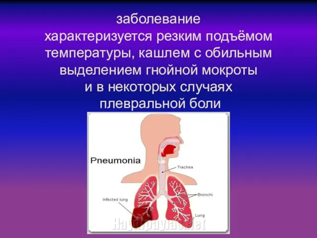 заболевание характеризуется резким подъёмом температуры, кашлем с обильным выделением гнойной