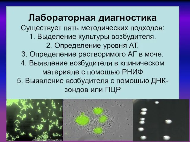 Лабораторная диагностика Существует пять методических подходов: 1. Выделение культуры возбудителя.