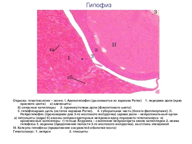 Гипофиз Окраска: гематоксилин – эозин. I. Аденогипофиз (развивается из кармана