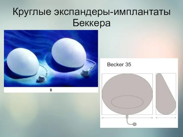 Круглые экспандеры-имплантаты Беккера