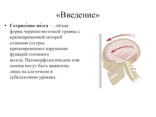 «Введение» Сотрясе́ние мо́зга — лёгкая форма черепно-мозговой травмы с кратковременной потерей сознания (острое