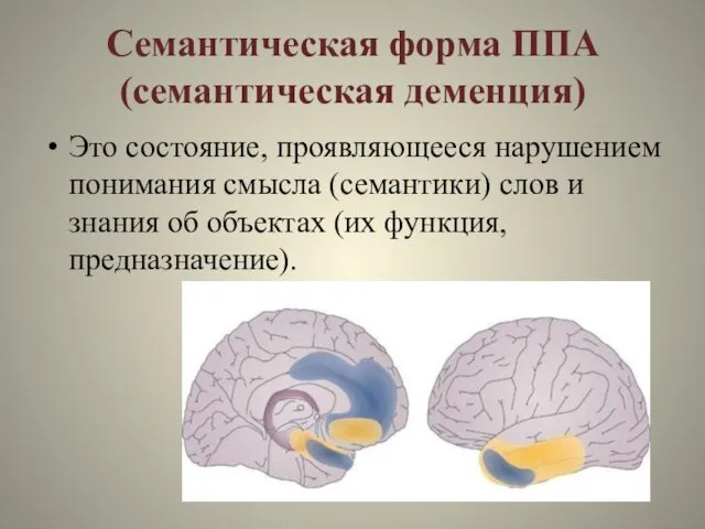 Семантическая форма ППА (семантическая деменция) Это состояние, проявляющееся нарушением понимания