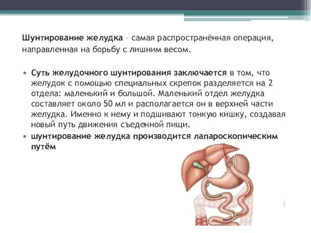 Шунтирование желудка – самая распространённая операция, направленная на борьбу с