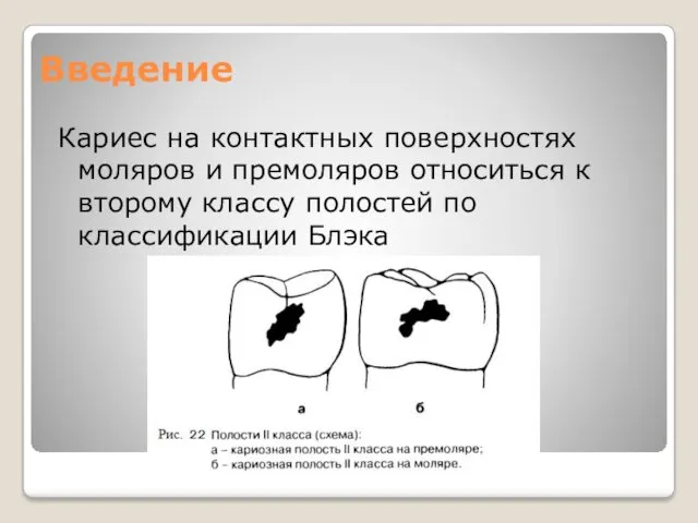 Введение Кариес на контактных поверхностях моляров и премоляров относиться к второму классу полостей по классификации Блэка