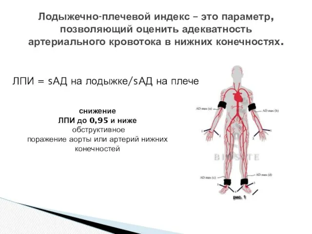 Лодыжечно-плечевой индекс – это параметр, позволяющий оценить адекватность артериального кровотока