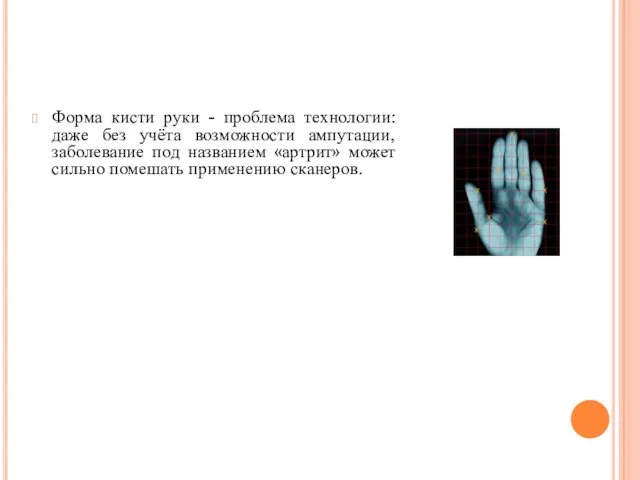 Форма кисти руки - проблема технологии: даже без учёта возможности ампутации, заболевание под