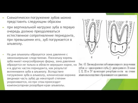 Схематически погружение зубов можно представить следующим образом при вертикальной нагрузке