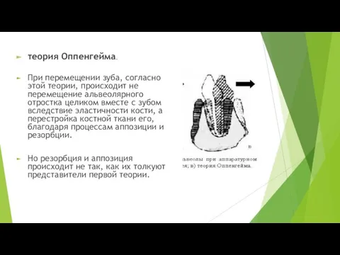 теория Оппенгейма. При перемещении зуба, согласно этой теории, происходит не