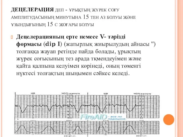 ДЕЦЕЛЕРАЦИЯ деп - ұрықтың жүрек соғу амплитудасының минутына 15 тен