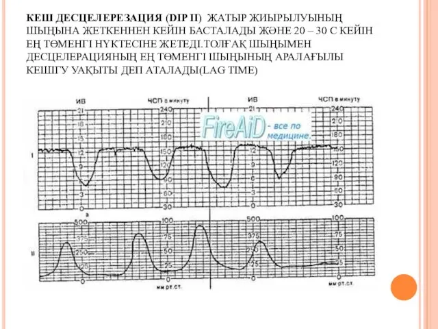 КЕШ ДЕСЦЕЛЕРЕЗАЦИЯ (DIP II) ЖАТЫР ЖИЫРЫЛУЫНЫҢ ШЫҢЫНА ЖЕТКЕННЕН КЕЙІН БАСТАЛАДЫ ЖӘНЕ 20 –