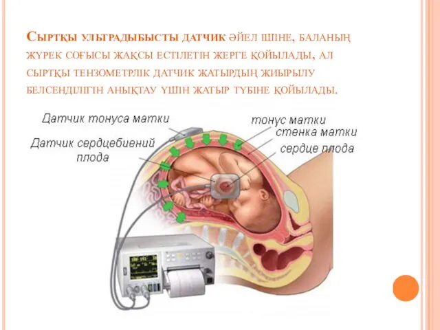 Сыртқы ультрадыбысты датчик әйел ішіне, баланың жүрек соғысы жақсы естілетін