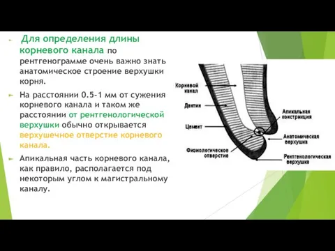 Для определения длины корневого канала по рентгенограмме очень важно знать