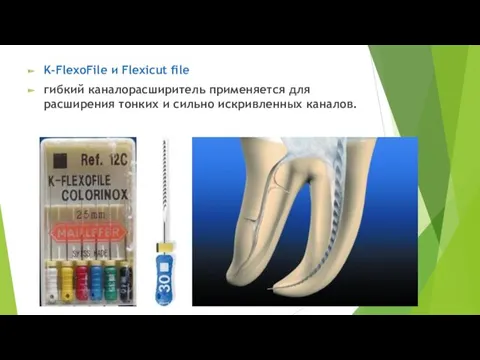 K-FlexoFile и Flexicut file гибкий каналорасширитель применяется для расширения тонких и сильно искривленных каналов.