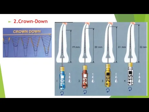 2.Crown-Down