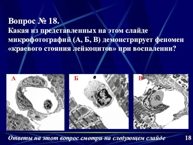 А Б В 18 Вопрос № 18. Какая из представленных