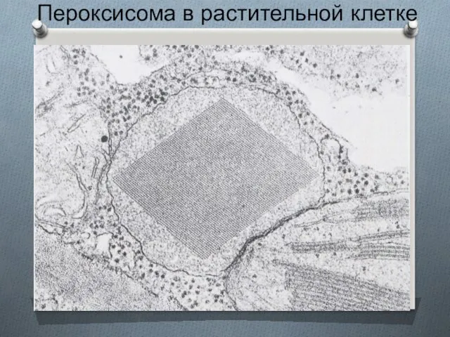 Пероксисома в растительной клетке