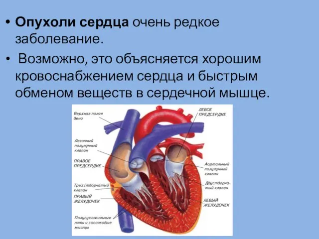 Опухоли сердца очень редкое заболевание. Возможно, это объясняется хорошим кровоснабжением