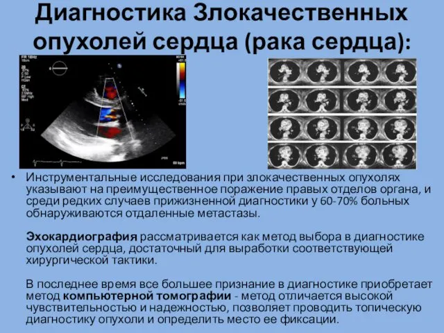 Диагностика Злокачественных опухолей сердца (рака сердца): Инструментальные исследования при злокачественных