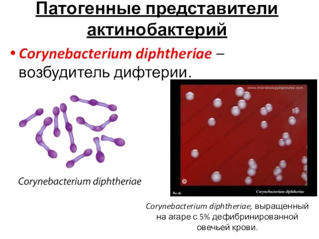 Патогенные представители актинобактерий Corynebacterium diphtheriae – возбудитель дифтерии. Corynebacterium diphtheriae,