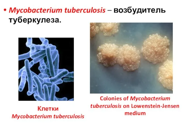 Mycobacterium tuberculosis – возбудитель туберкулеза. Colonies of Mycobacterium tuberculosis on Lowenstein-Jensen medium Клетки Mycobacterium tuberculosis