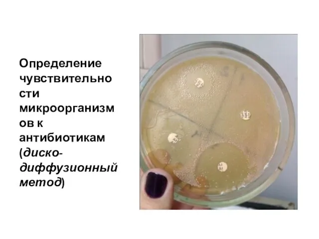 Определение чувствительности микроорганизмов к антибиотикам (диско-диффузионный метод)