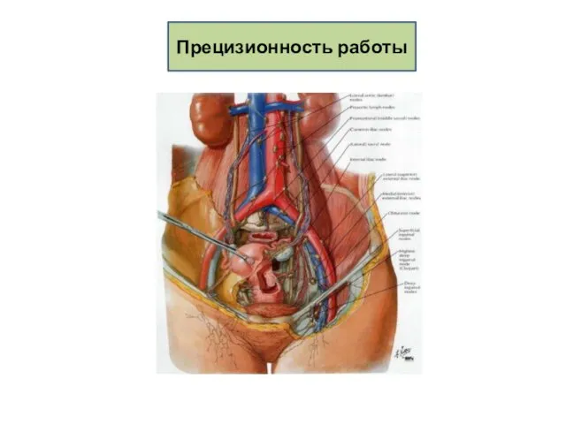 Прецизионность работы