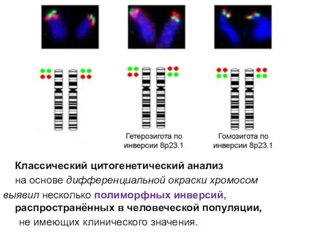 Классический цитогенетический анализ на основе дифференциальной окраски хромосом выявил несколько