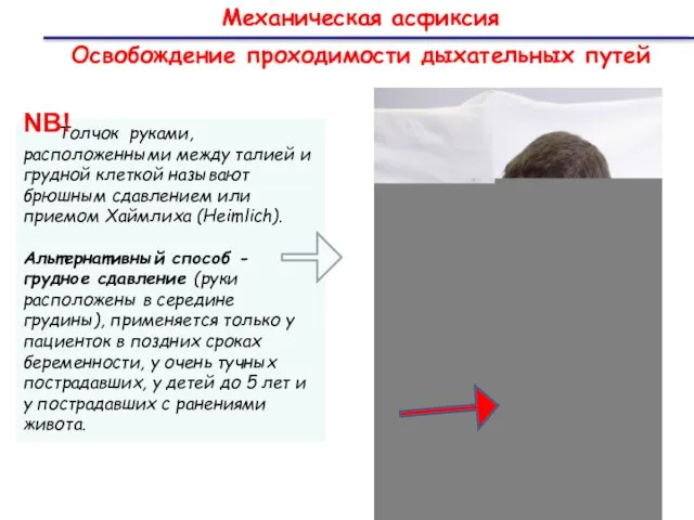 Механическая асфиксия Освобождение проходимости дыхательных путей Толчок руками, расположенными между