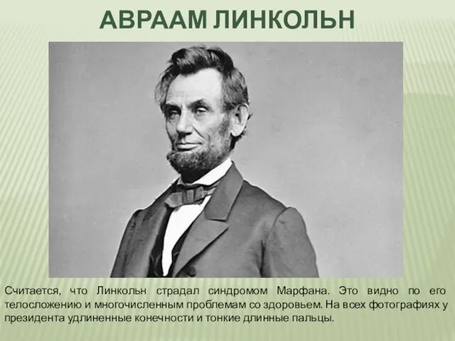 АВРААМ ЛИНКОЛЬН Считается, что Линкольн страдал синдромом Марфана. Это видно