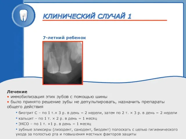 ТРАВМА ЗУБА 7-летний ребенок Лечение • иммобилизация этих зубов с помощью шины •