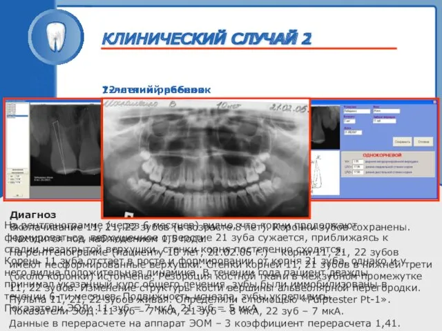 ТРАВМА ЗУБА 7-летний ребенок На рентгенограмме (через 6 месяцев) видно, что корни продолжают