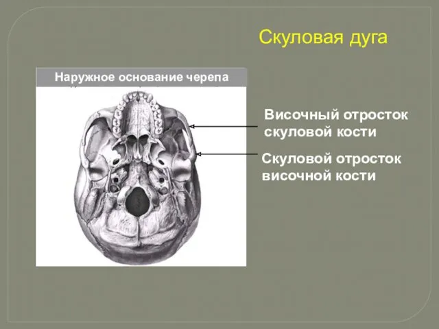 Скуловой отросток височной кости Височный отросток скуловой кости Скуловая дуга Наружное основание черепа