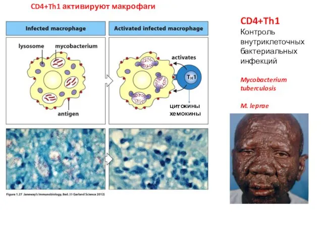CD4+Th1 Контроль внутриклеточных бактериальных инфекций Mycobacterium tuberculosis M. leprae CD4+Th1 активируют макрофаги