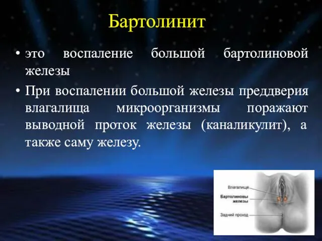 Бартолинит это воспаление большой бартолиновой железы При воспалении большой железы