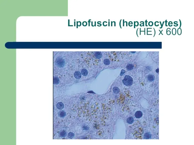 Lipofuscin (hepatocytes) (НЕ) х 600