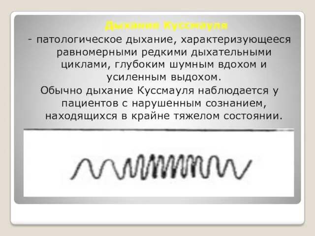 Дыхание Куссмауля - патологическое дыхание, характеризующееся равномерными редкими дыхательными циклами,