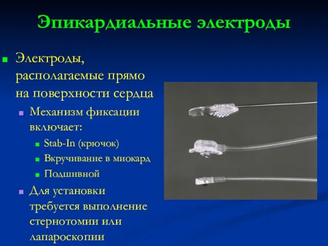 Эпикардиальные электроды Электроды, располагаемые прямо на поверхности сердца Механизм фиксации