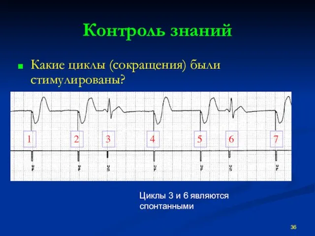 Контроль знаний Какие циклы (сокращения) были стимулированы? 1 2 7