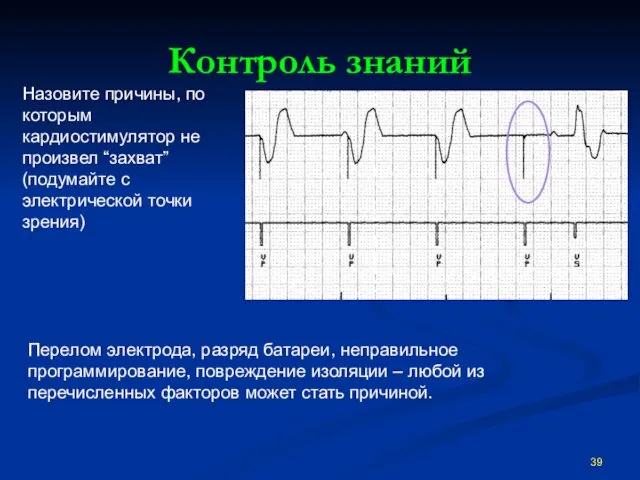 Контроль знаний Перелом электрода, разряд батареи, неправильное программирование, повреждение изоляции