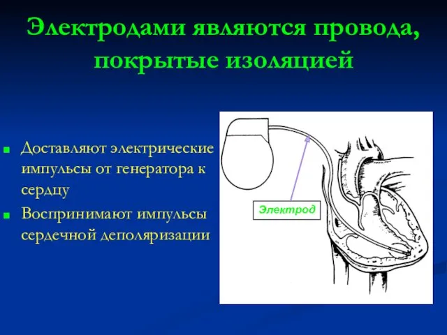 Электродами являются провода, покрытые изоляцией Доставляют электрические импульсы от генератора