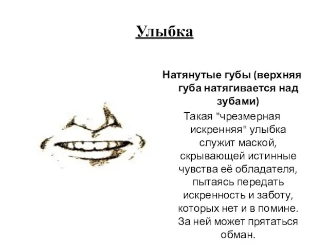 Улыбка Натянутые губы (верхняя губа натягивается над зубами) Такая "чрезмерная